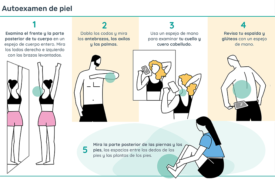 Autoexamen de piel