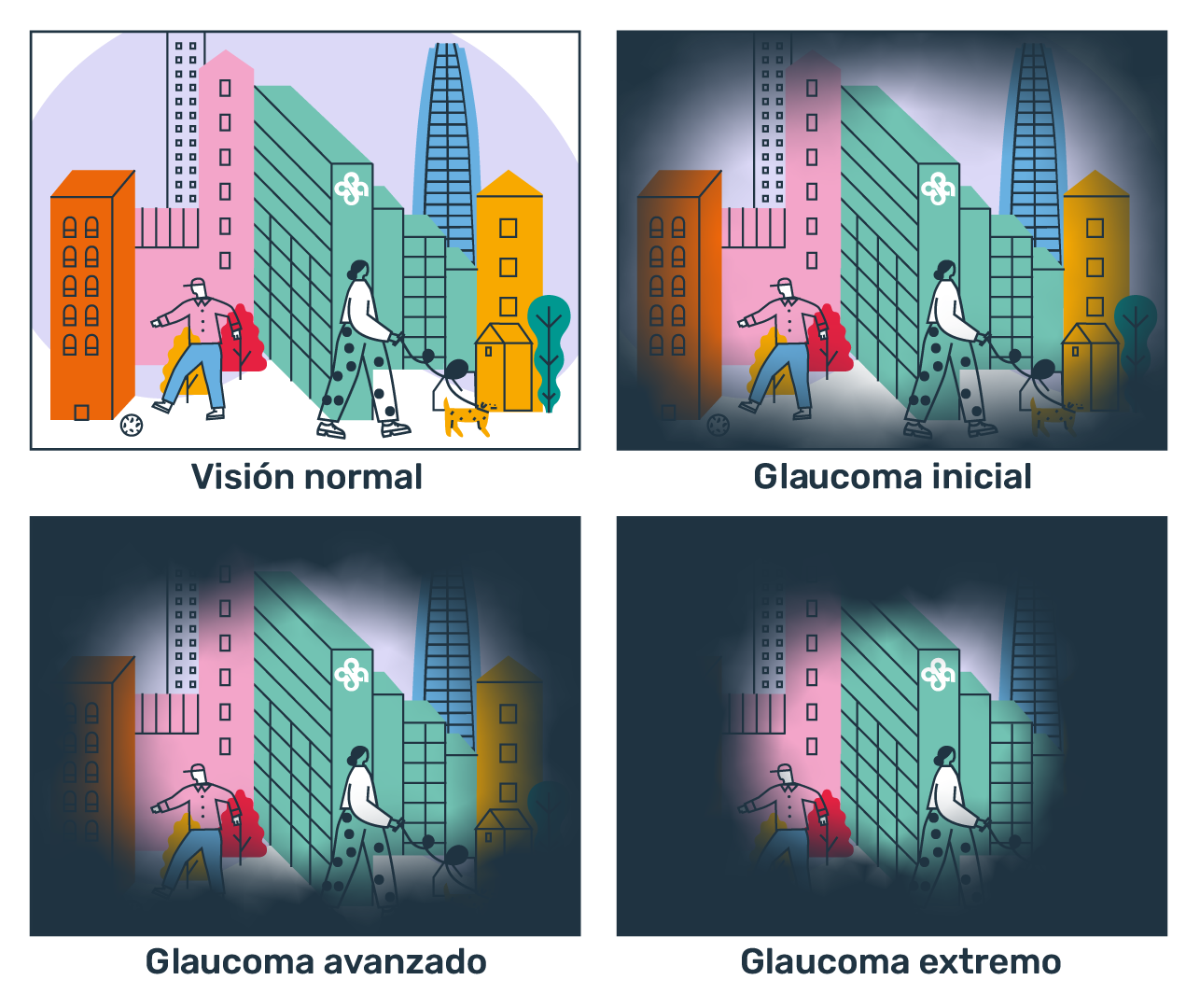 Inforgrafía de visión normal a glaucoma extremo