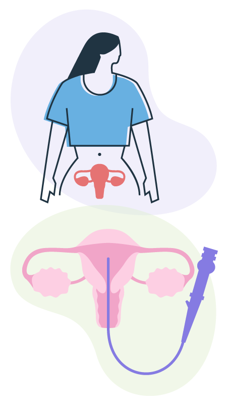 Icono histerescopía