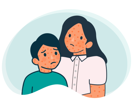 Icono adulto y niño con viruela