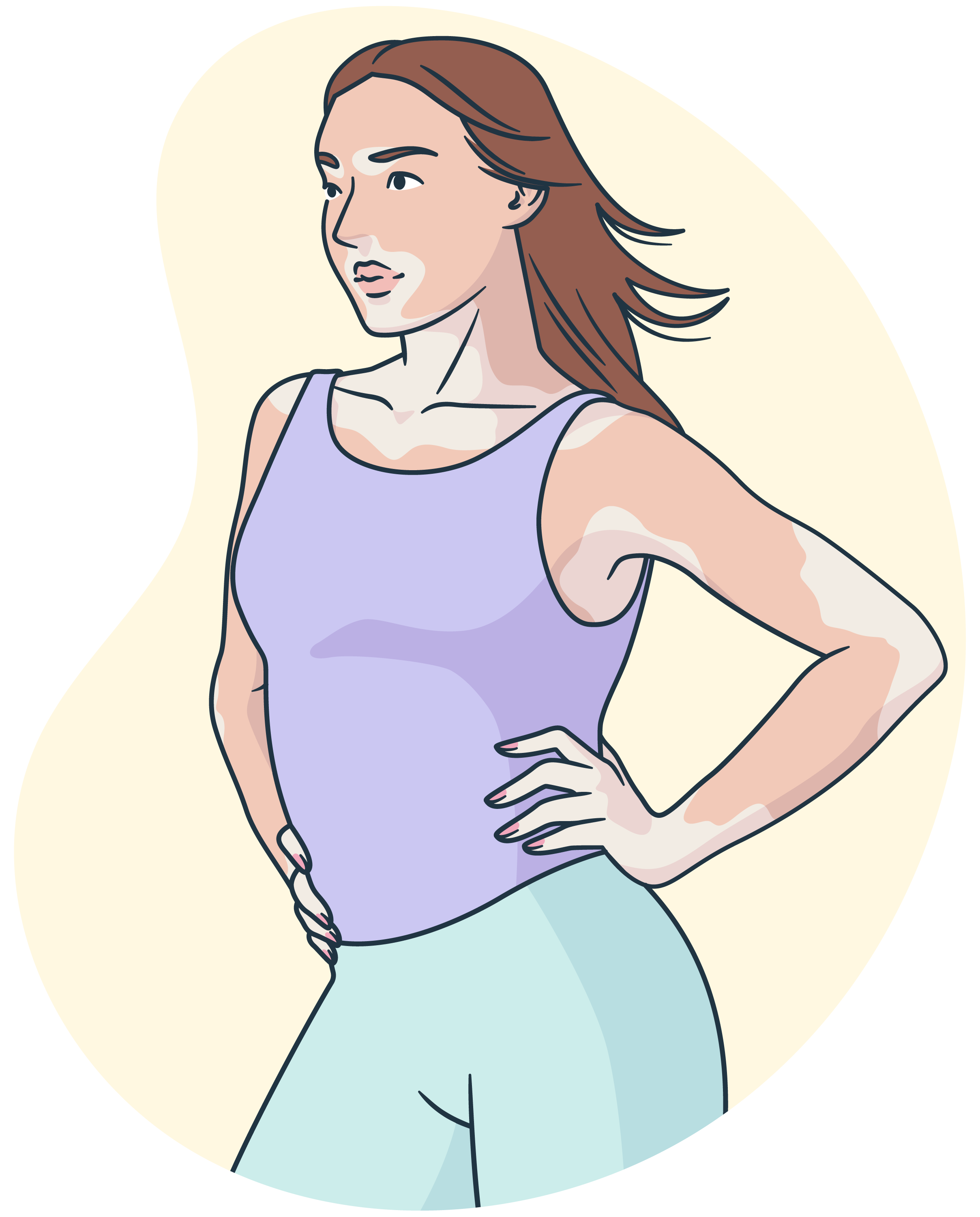 Mujer con vitiligo en rostro y cuerpo.