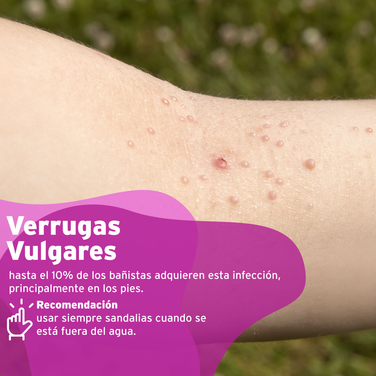 clinicaalemana_articulos_salud_enfermedades_piscina_5