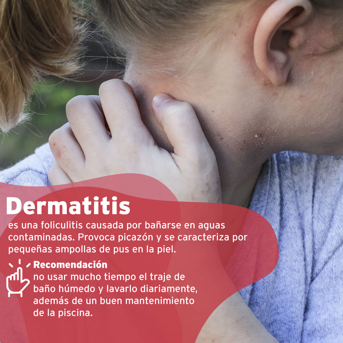 clinicaalemana_articulos_salud_enfermedades_piscina_7