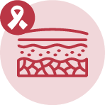 Cáncer de piel