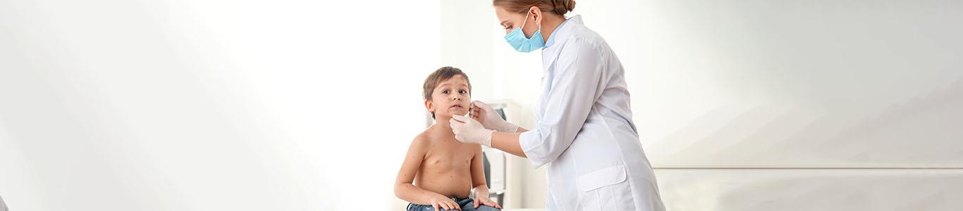 Viruela del mono: qué es y cómo se contagia